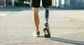 What Is a Bionic Leg? 
